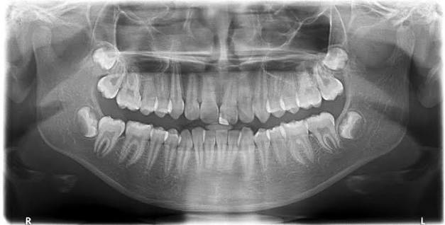 Digital 3D X-Ray & OPG Suite